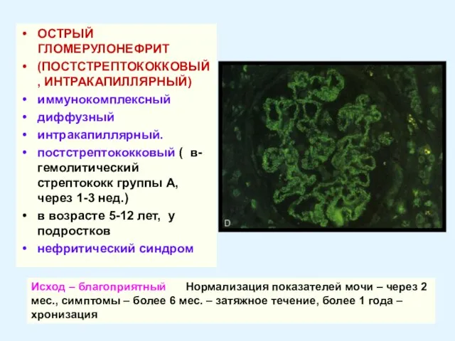 ОСТРЫЙ ГЛОМЕРУЛОНЕФРИТ (ПОСТСТРЕПТОКОККОВЫЙ, ИНТРАКАПИЛЛЯРНЫЙ) иммунокомплексный диффузный интракапиллярный. постстрептококковый ( в-гемолитический стрептококк группы