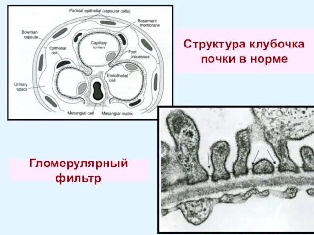 Структура клубочка почки в норме Гломерулярный фильтр