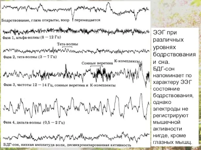 ЭЭГ при различных уровнях бодрствования и сна. БДГ-сон напоминает по характеру ЭЭГ