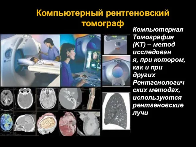 Компьютерный рентгеновский томограф Компьютерная Томография (KT) – метод исследован я, при котором,