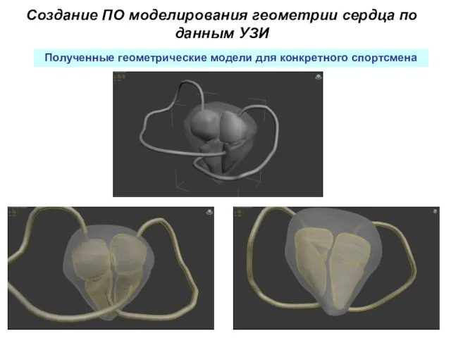 Создание ПО моделирования геометрии сердца по данным УЗИ Полученные геометрические модели для конкретного спортсмена