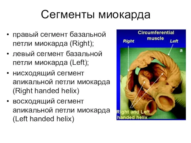 Сегменты миокарда правый сегмент базальной петли миокарда (Right); левый сегмент базальной петли