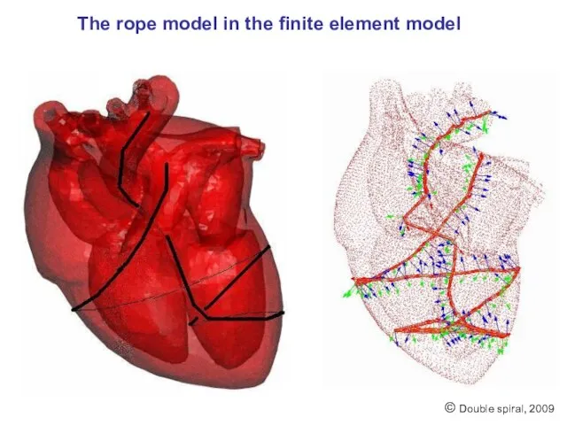 The rope model in the finite element model © Double spiral, 2009