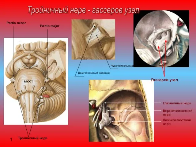 Тройничный нерв - гассеров узел Глазничный нерв Верхнечелюстной нерв Нижнечелюстной нерв Гассеров