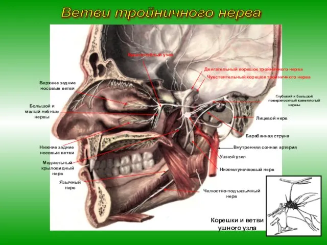 Ушной узел Лицевой нерв Барабанная струна Двигательный корешок тройничного нерва Чувствительный корешок