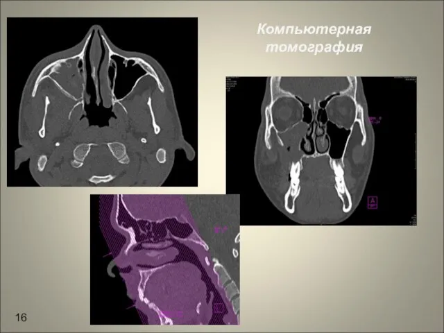 Компьютерная томография 16