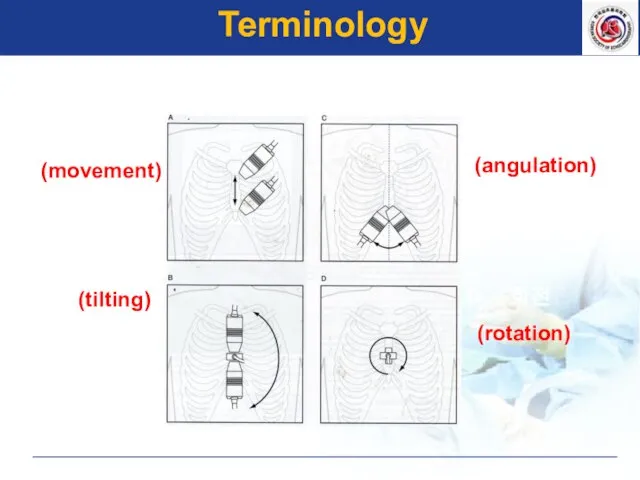 A. 이동 (movement) 기울임 (tilting) C. 경사 (angulation) 회전 (rotation) Terminology