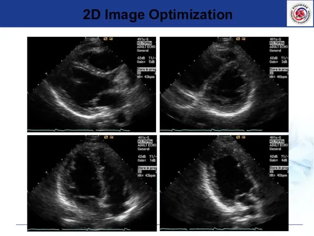 2D Image Optimization