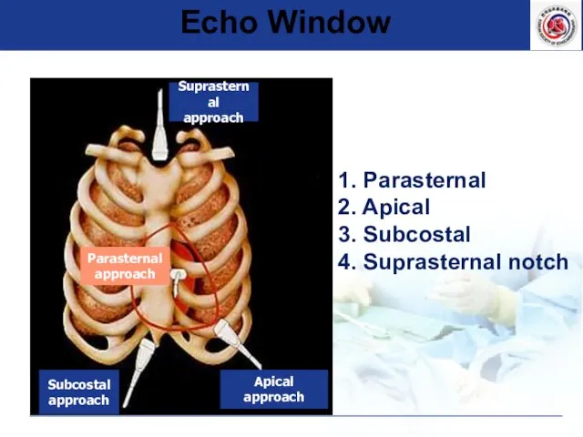 Echo Window 1. Parasternal 2. Apical 3. Subcostal 4. Suprasternal notch