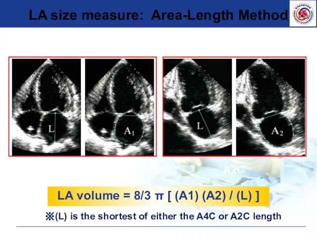 A4C A2C LA volume = 8/3 π [ (A1) (A2) / (L)