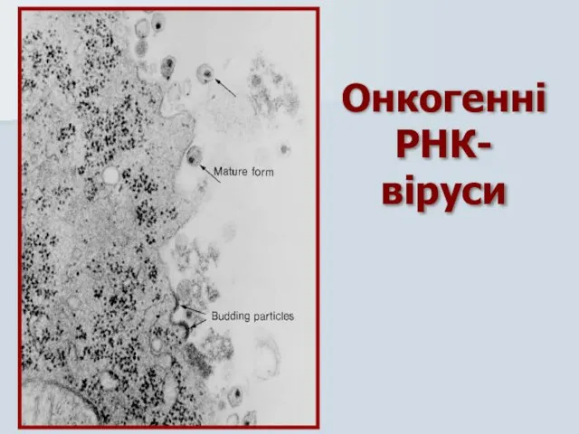 Онкогенні РНК- віруси