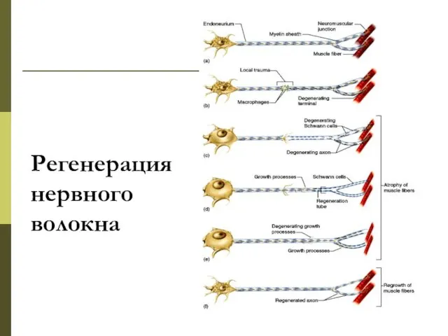 Регенерация нервного волокна