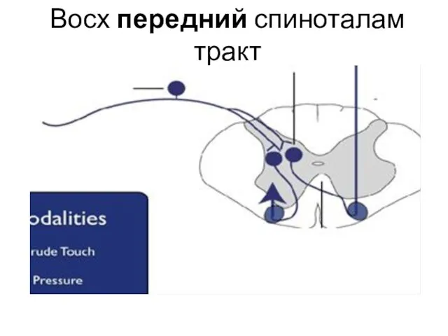 Восх передний спиноталам тракт