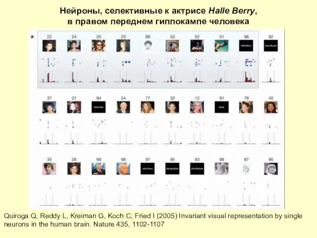 Нейроны, селективные к актрисе Halle Berry, в правом переднем гиппокампе человека