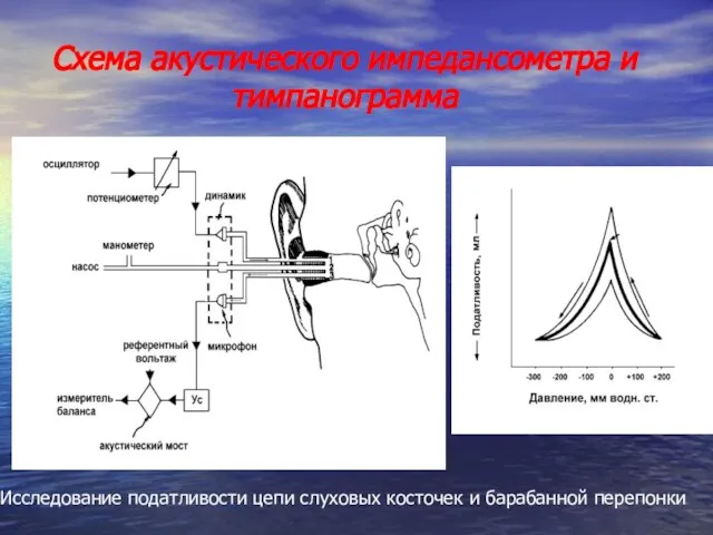 Схема акустического импедансометра и тимпанограмма Исследование податливости цепи слуховых косточек и барабанной перепонки