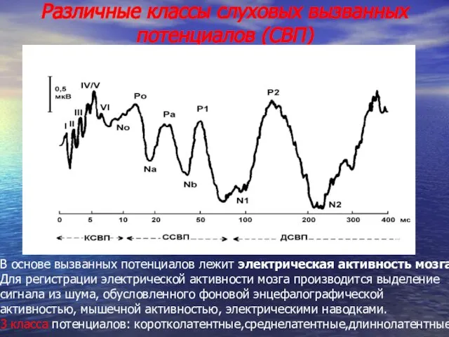 Различные классы слуховых вызванных потенциалов (СВП) В основе вызванных потенциалов лежит электрическая