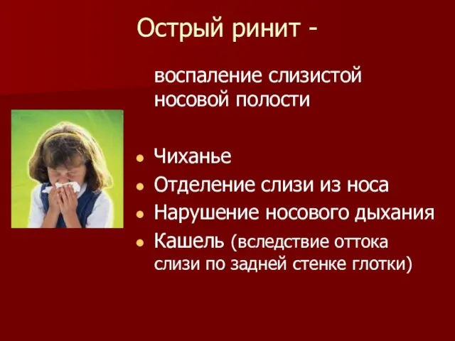 Острый ринит - воспаление слизистой носовой полости Чиханье Отделение слизи из носа