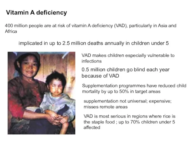 400 million people are at risk of vitamin A deficiency (VAD), particularly