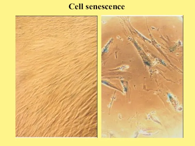 Cell senescence