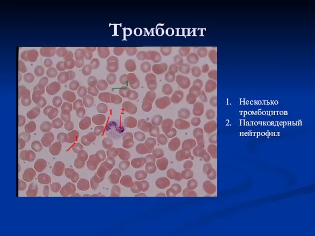 Тромбоцит Несколько тромбоцитов Палочкоядерный нейтрофил