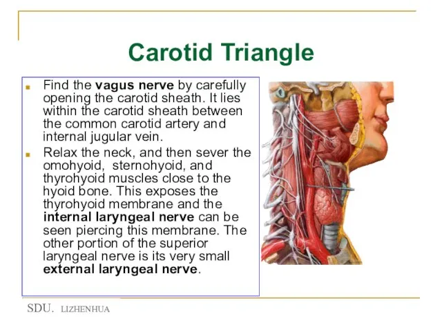 Carotid Triangle Find the vagus nerve by carefully opening the carotid sheath.