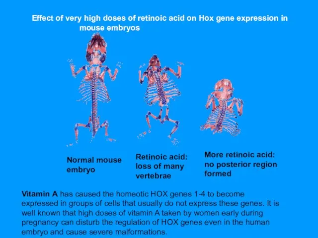 Normal mouse embryo Retinoic acid: loss of many vertebrae More retinoic acid:
