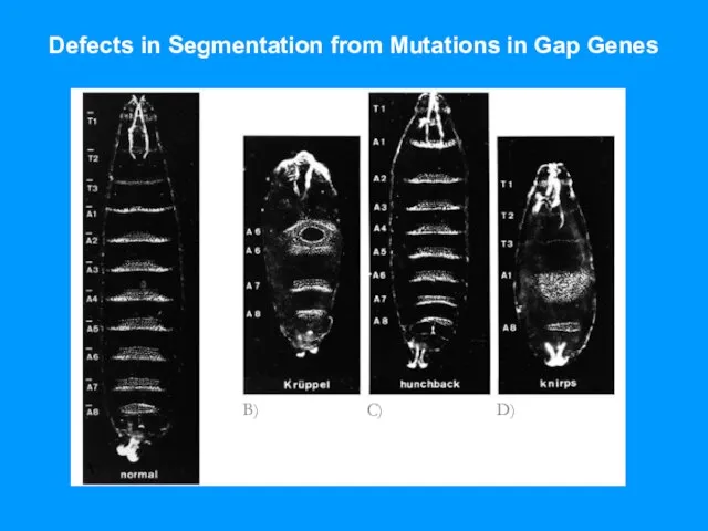 Defects in Segmentation from Mutations in Gap Genes A) B) C) D)