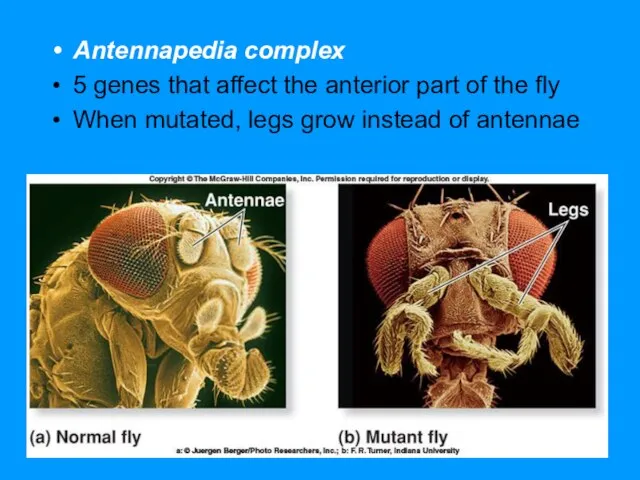Antennapedia complex 5 genes that affect the anterior part of the fly