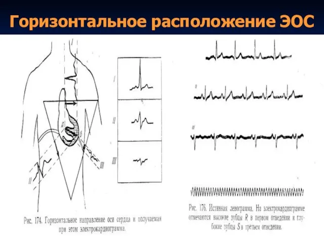 Горизонтальное расположение ЭОС