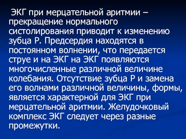 ЭКГ при мерцательной аритмии – прекращение нормального систолирования приводит к изменению зубца