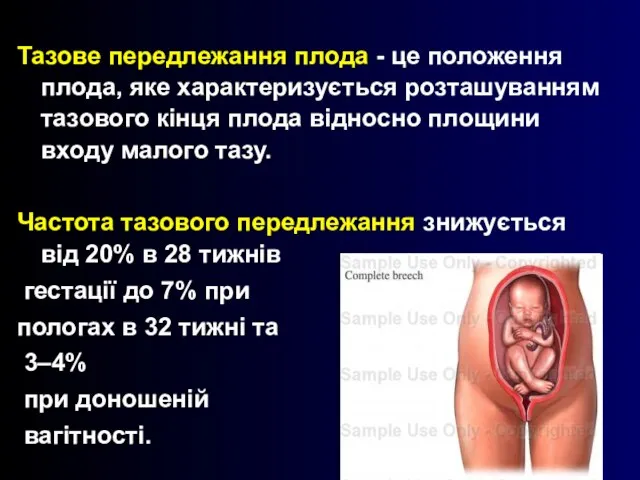 Тазове передлежання плода - це положення плода, яке характеризується розташуванням тазового кінця