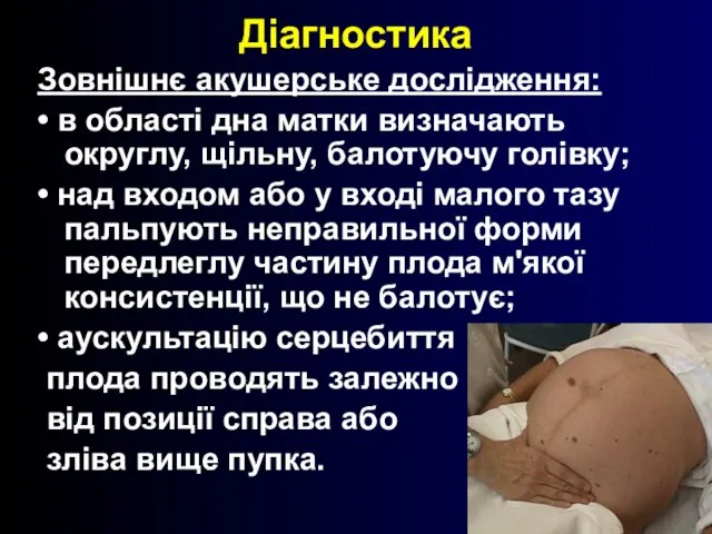 Діагностика Зовнішнє акушерське дослідження: • в області дна матки визначають округлу, щільну,