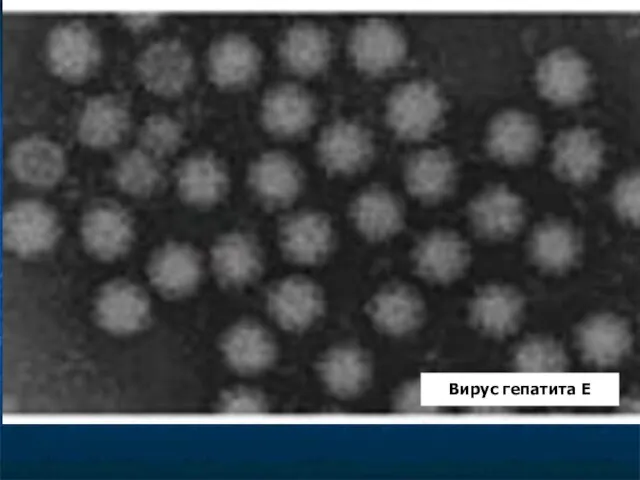 Вирус гепатита Е