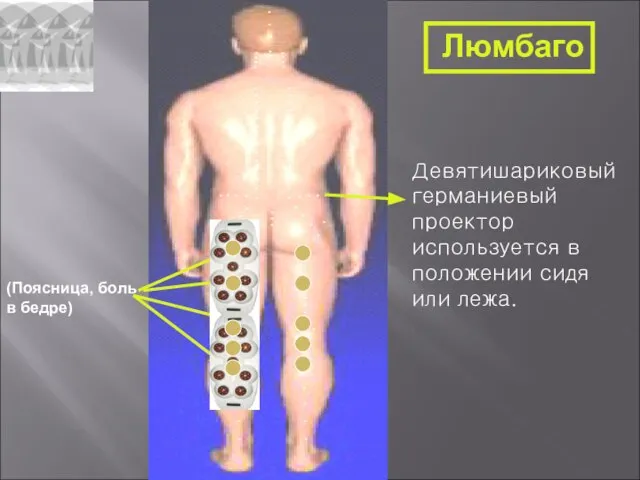 Девятишариковый германиевый проектор используется в положении сидя или лежа. Люмбаго (Поясница, боль в бедре)