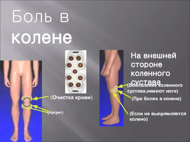 На внешней стороне коленного сустава (Артрит) (Воспаление коленного сустава,немеют ноги) (Если не