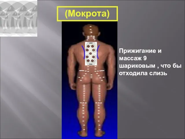 Прижигание и массаж 9 шариковым , что бы отходила слизь (Мокрота)