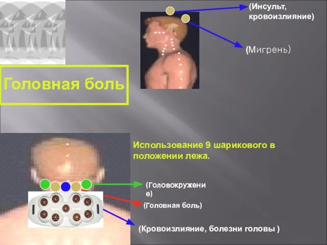 (Инсульт, кровоизлияние) (Мигрень) (Головокружение) (Головная боль) (Кровоизлияние, болезни головы ) Головная боль