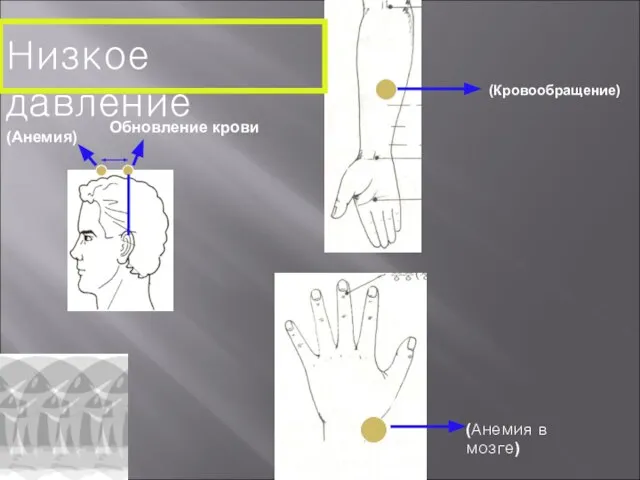 Низкое давление Обновление крови (Анемия) (Анемия в мозге) (Кровообращение)