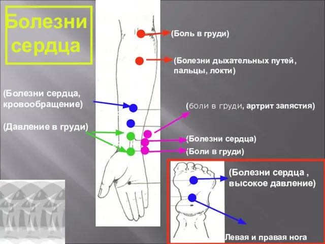 Болезни сердца (Боль в груди) (Болезни сердца, кровообращение) (Давление в груди) (боли