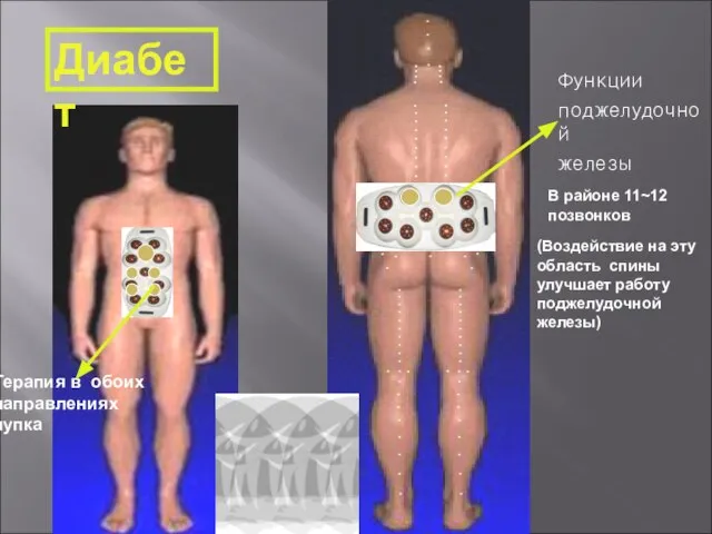 Терапия в обоих направлениях пупка В районе 11~12 позвонков (Воздействие на эту