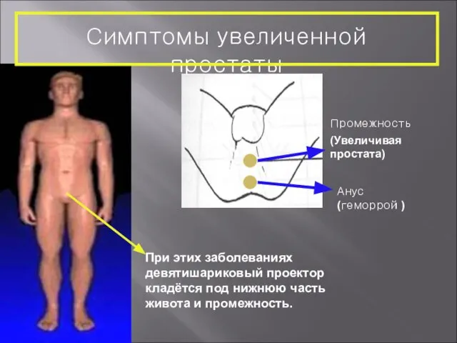 При этих заболеваниях девятишариковый проектор кладётся под нижнюю часть живота и промежность.