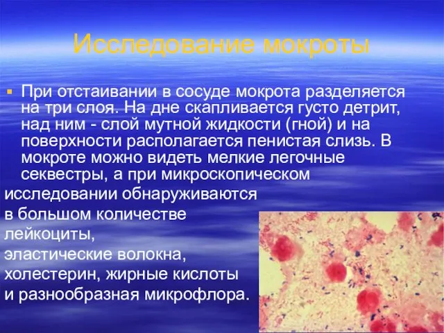 Исследование мокроты При отстаивании в сосуде мокрота разделяется на три слоя. На