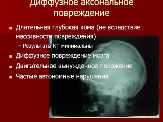 Диффузное аксональное повреждение Длительная глубокая кома (не вследствие массивности повреждения) Результаты КТ