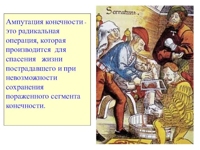 Ампутация конечности - это радикальная операция, которая производится для спасения жизни пострадавшего