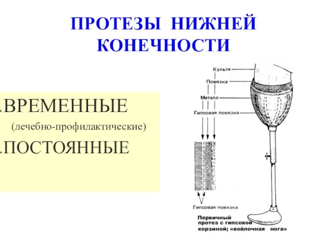 ПРОТЕЗЫ НИЖНЕЙ КОНЕЧНОСТИ ВРЕМЕННЫЕ (лечебно-профилактические) ПОСТОЯННЫЕ