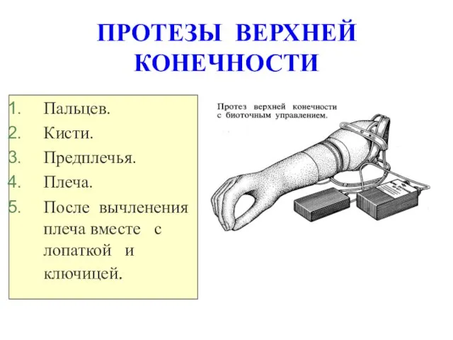 ПРОТЕЗЫ ВЕРХНЕЙ КОНЕЧНОСТИ Пальцев. Кисти. Предплечья. Плеча. После вычленения плеча вместе с лопаткой и ключицей.