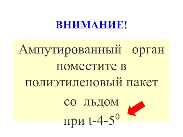 ВНИМАНИЕ! Ампутированный орган поместите в полиэтиленовый пакет со льдом при t-4-50