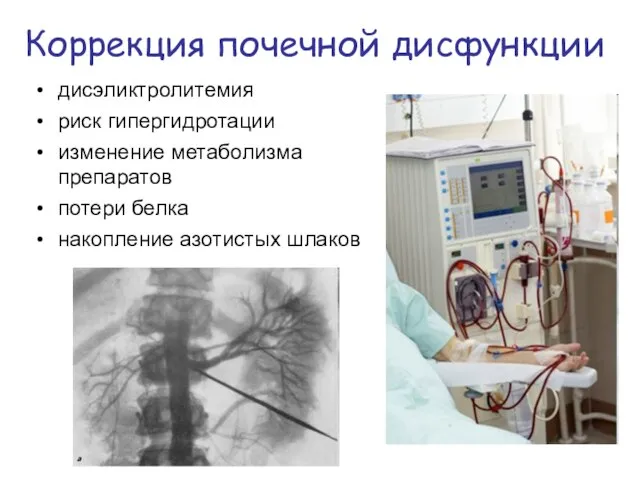 Коррекция почечной дисфункции дисэликтролитемия риск гипергидротации изменение метаболизма препаратов потери белка накопление азотистых шлаков