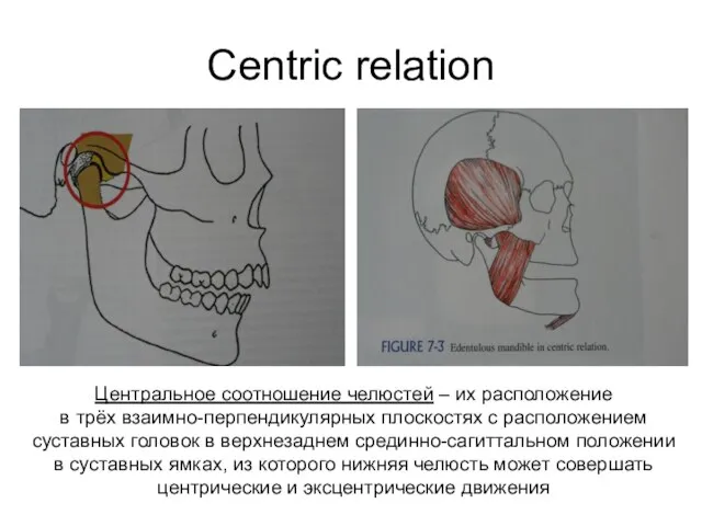 Centric relation Центральное соотношение челюстей – их расположение в трёх взаимно-перпендикулярных плоскостях