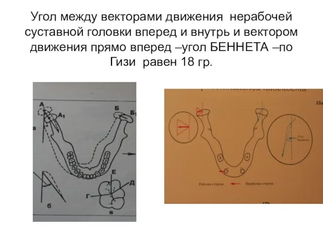 Угол между векторами движения нерабочей суставной головки вперед и внутрь и вектором